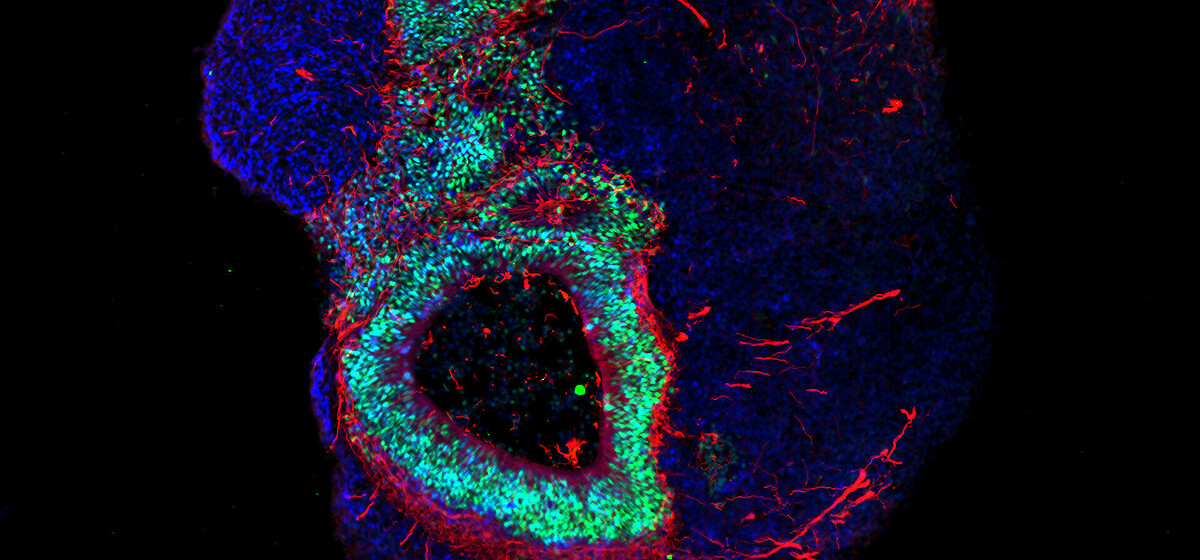 Let’s get cellular – an image from the Max Delbrück Center for Molecular Medicine Cell-based treatment marks a major milestone in patient-centricity.